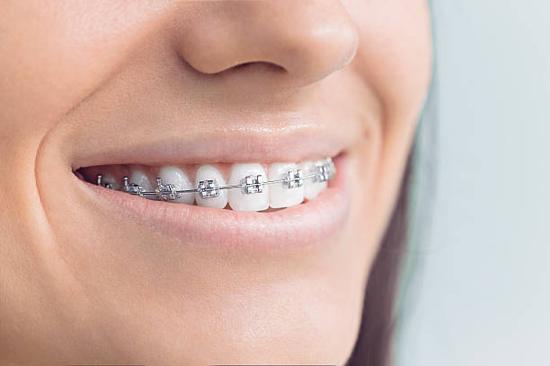 Best Teeth Whitening  in Rlsbad, CA